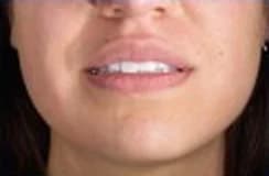 Example photo: lips relaxed