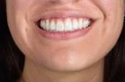 Example photo: natural smile