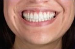 Example photo: wide smile