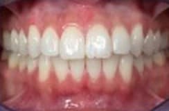 Example photo: front, teeth together