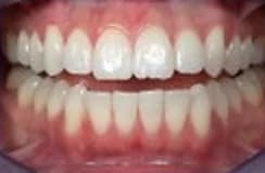 Example photo: front, slightly apart