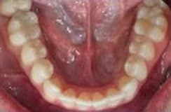Example photo: lower teeth